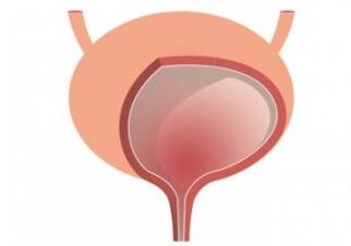 bladder and strengthening of the femixal organ capsules